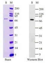 MDM2（小鼠双分钟2）人类癌蛋白